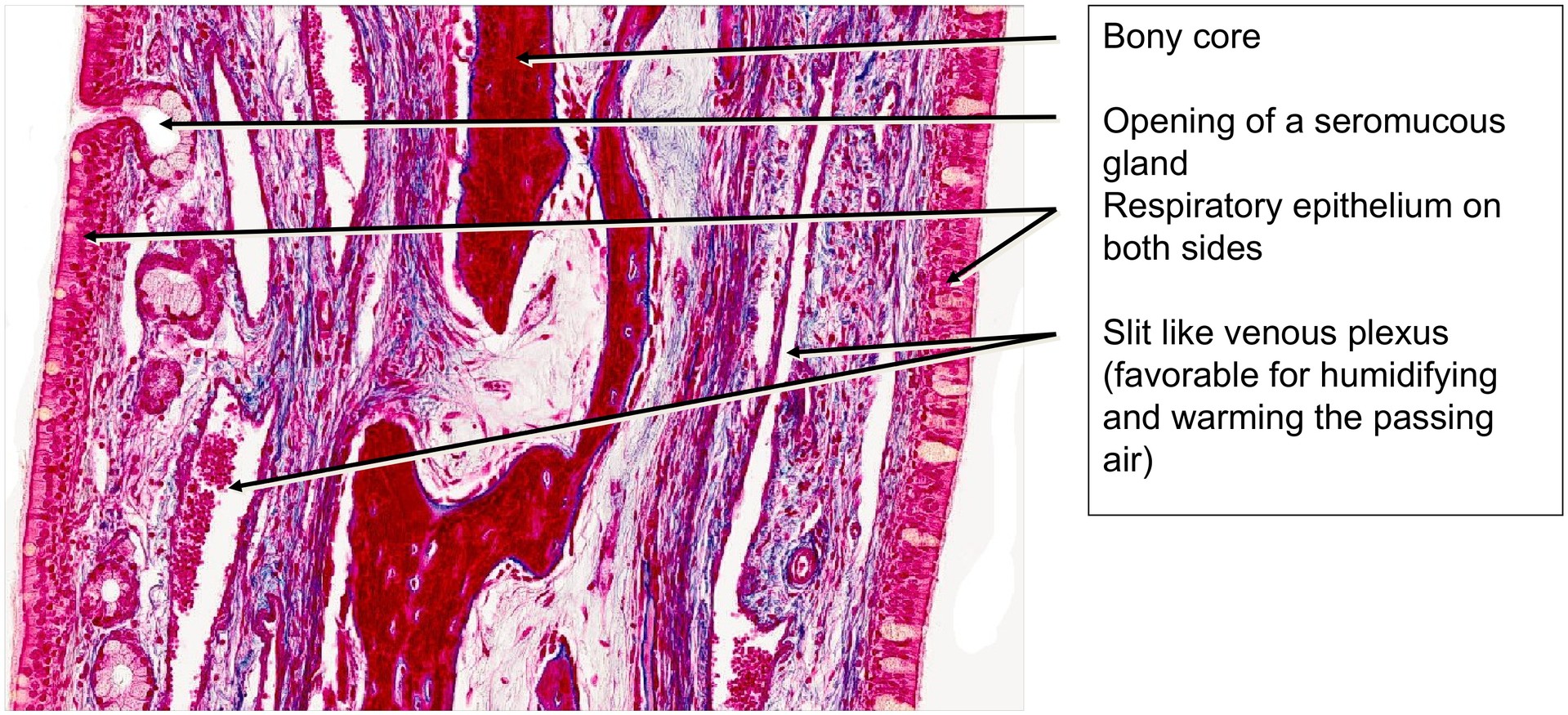 Nasal concha