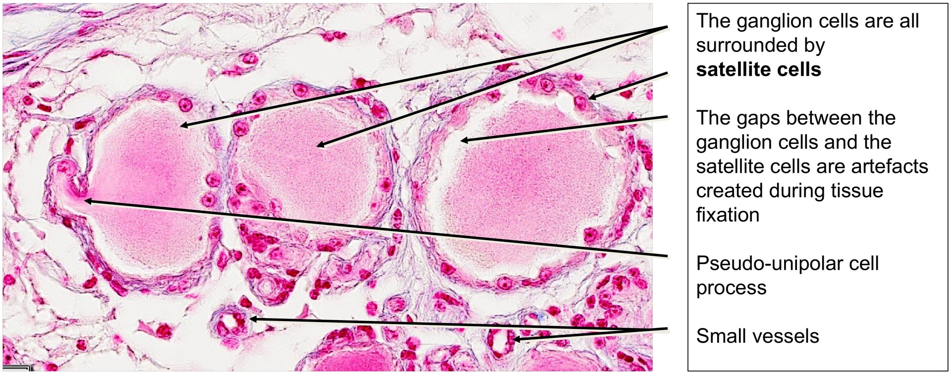 Spinal ganglion