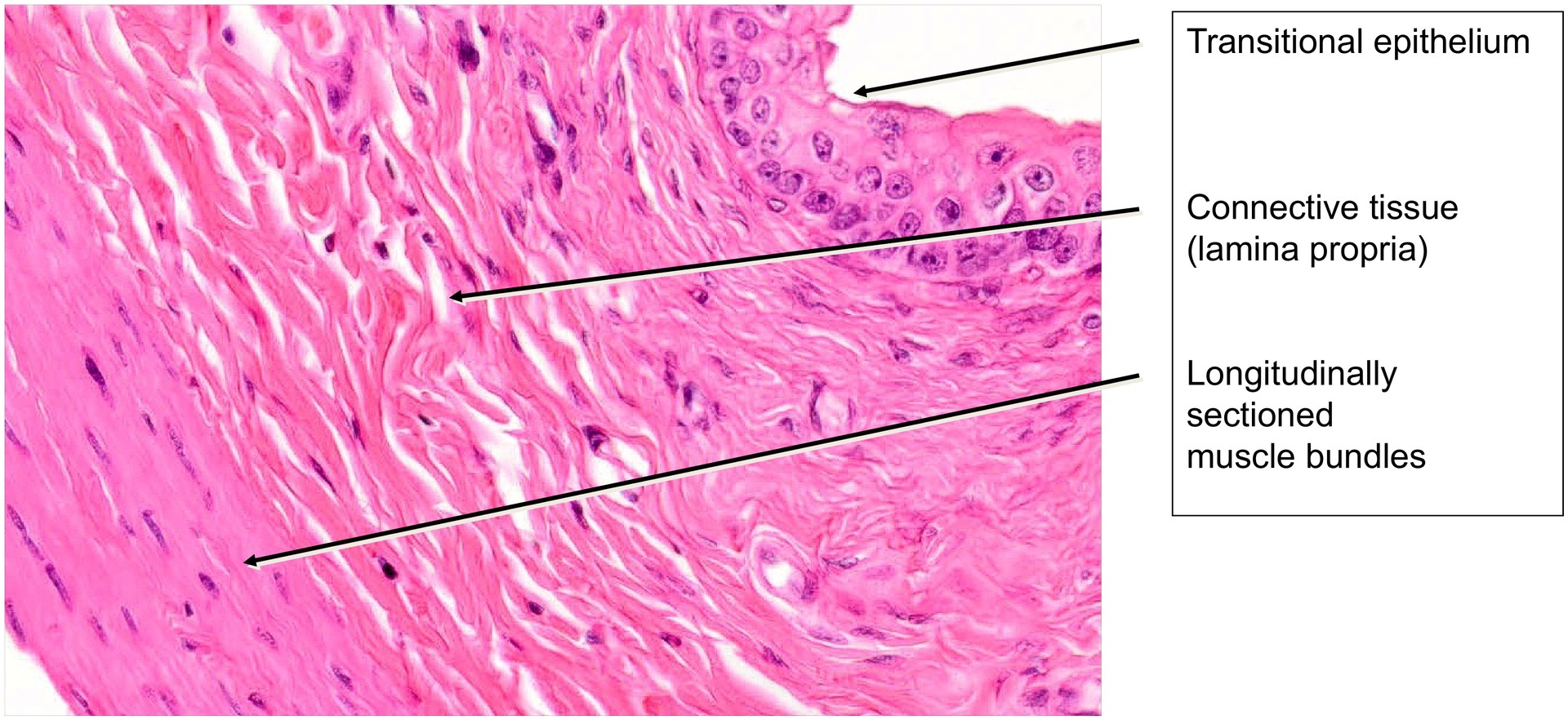 Urinary bladder