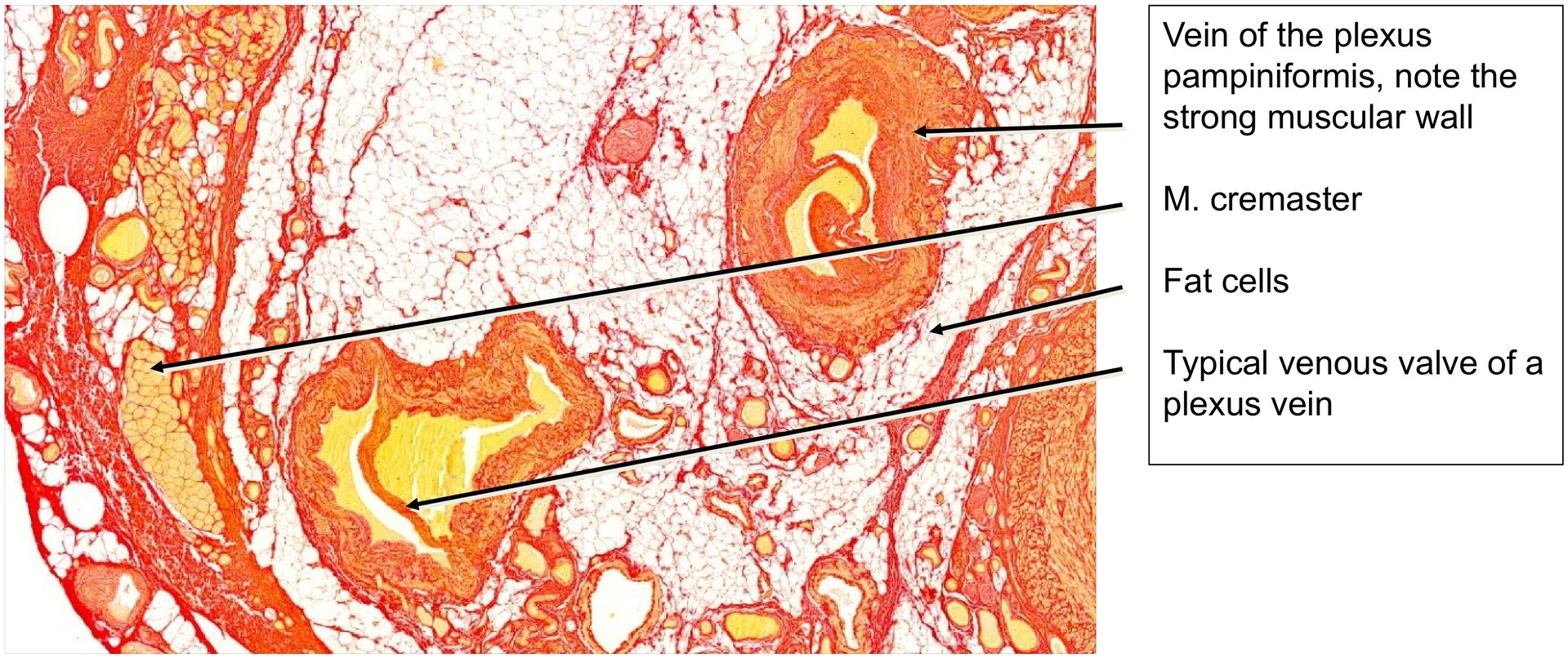 Spermatic cord