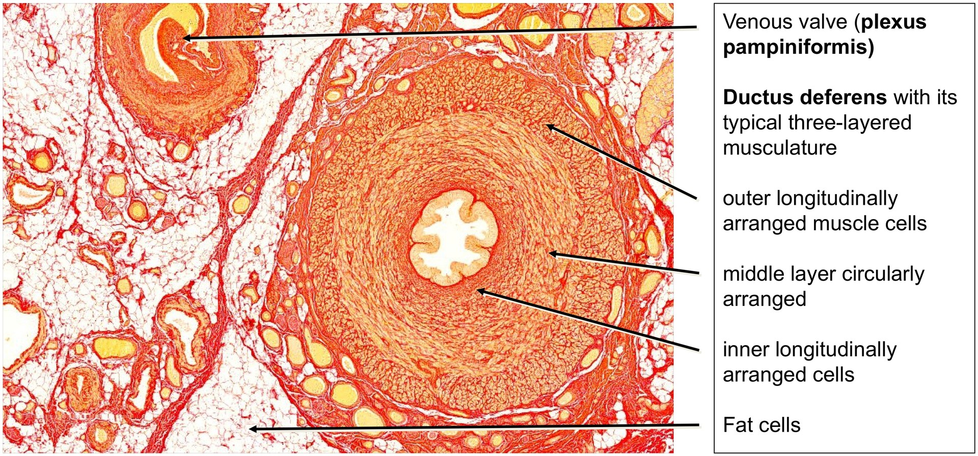 Spermatic cord