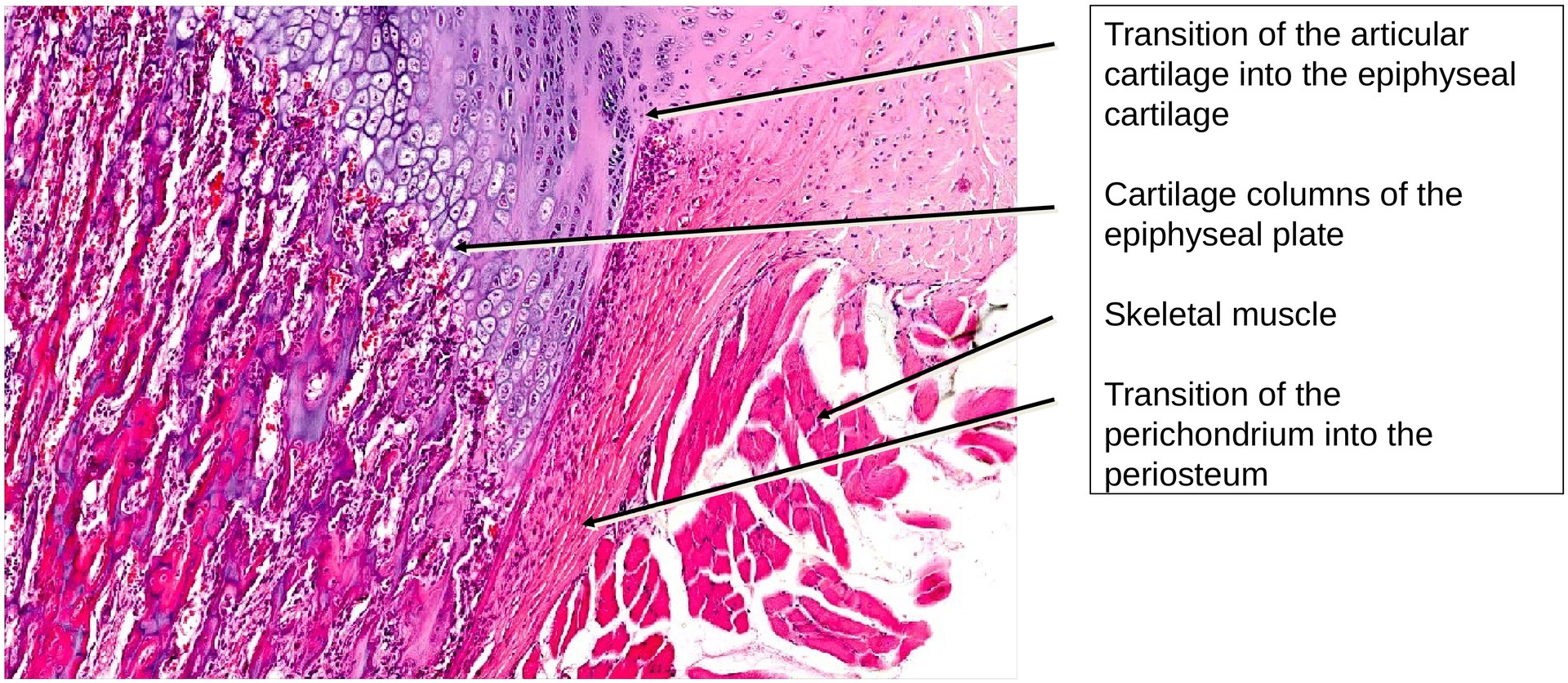 Ossification, endochondral