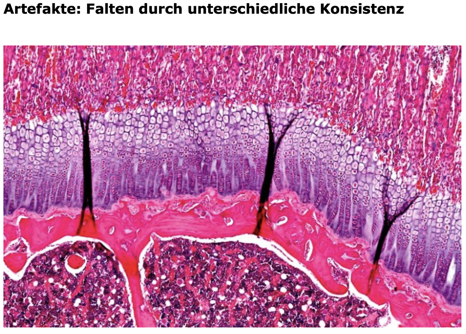 Artefalt 2