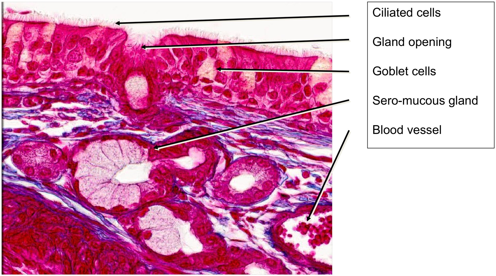 Nasal concha