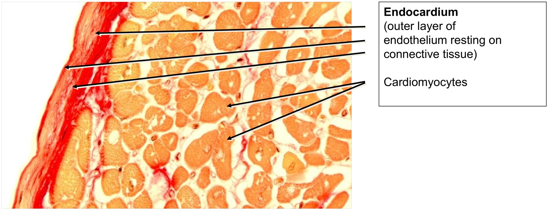 Papillary muscle