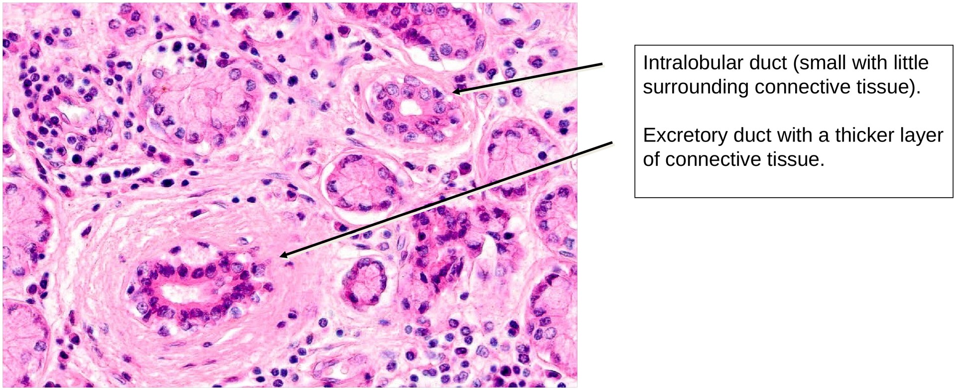 Lacrimal gland