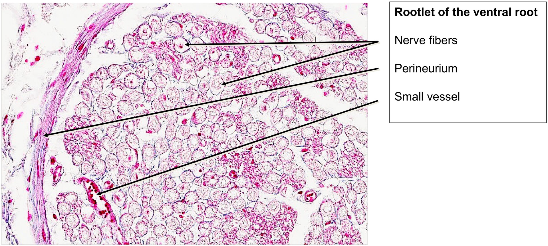 Spinal ganglion