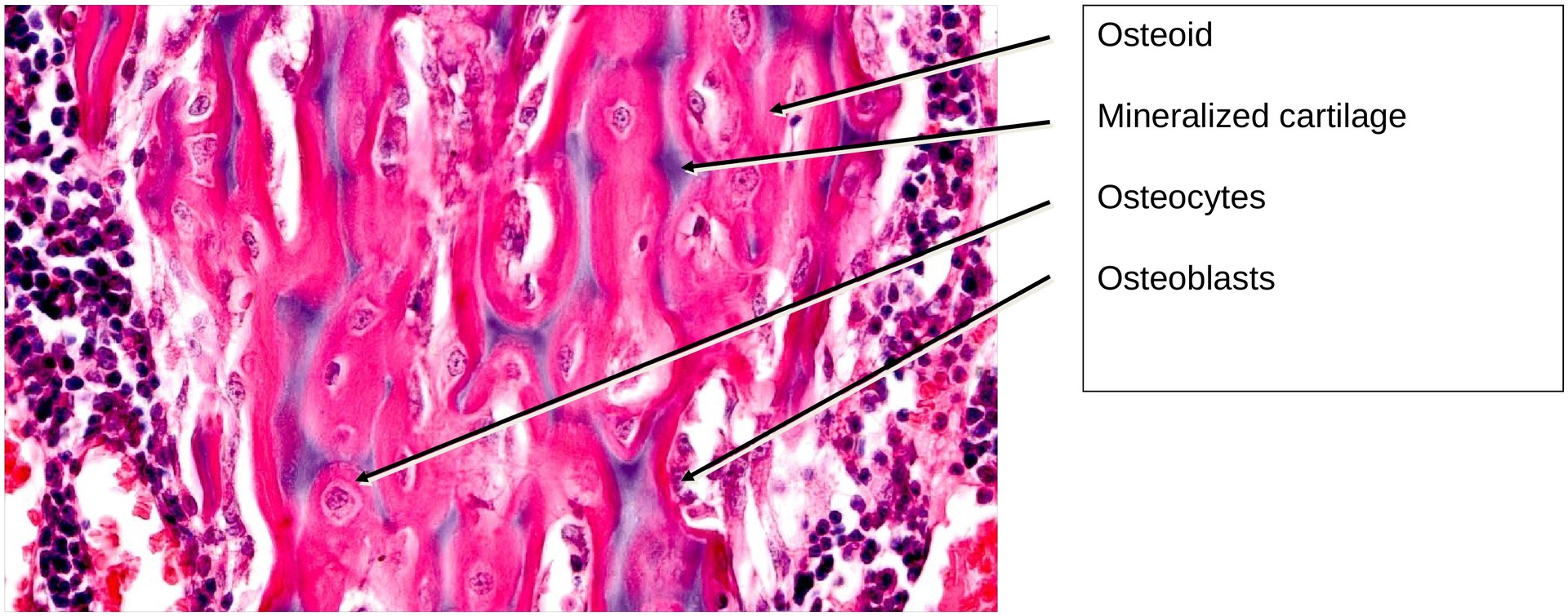 Ossification, endochondral