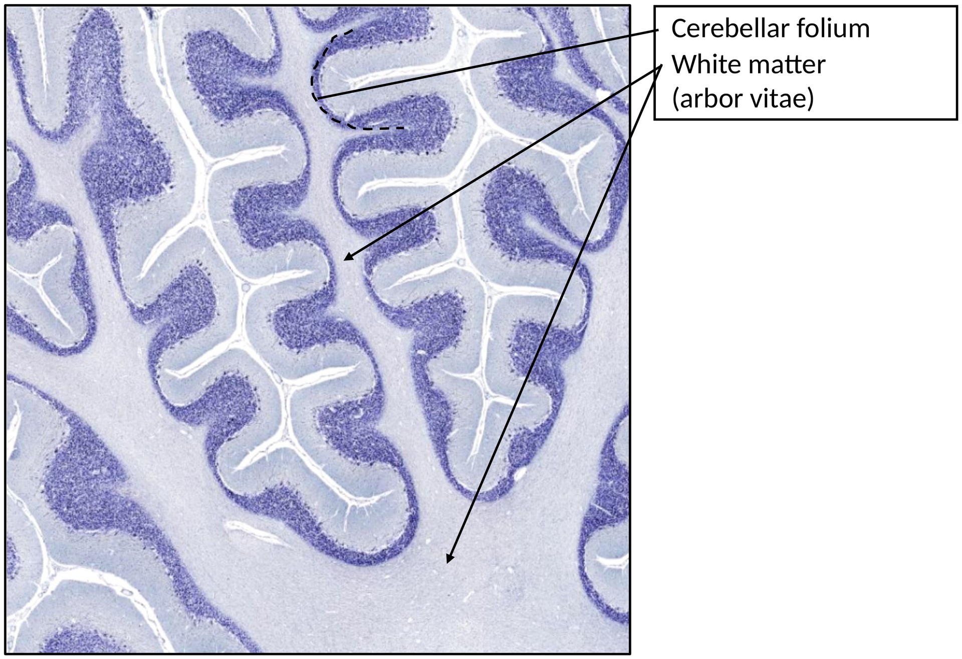 Cerebellum 2