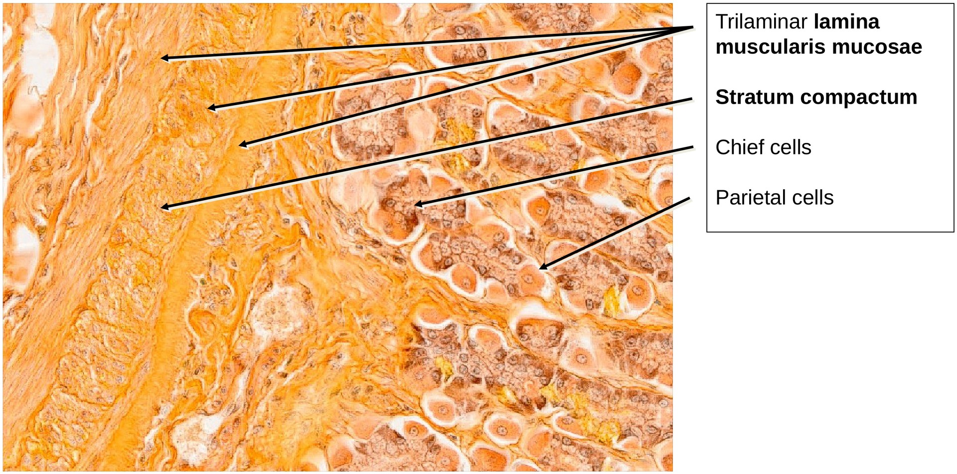 Stomach, fundus