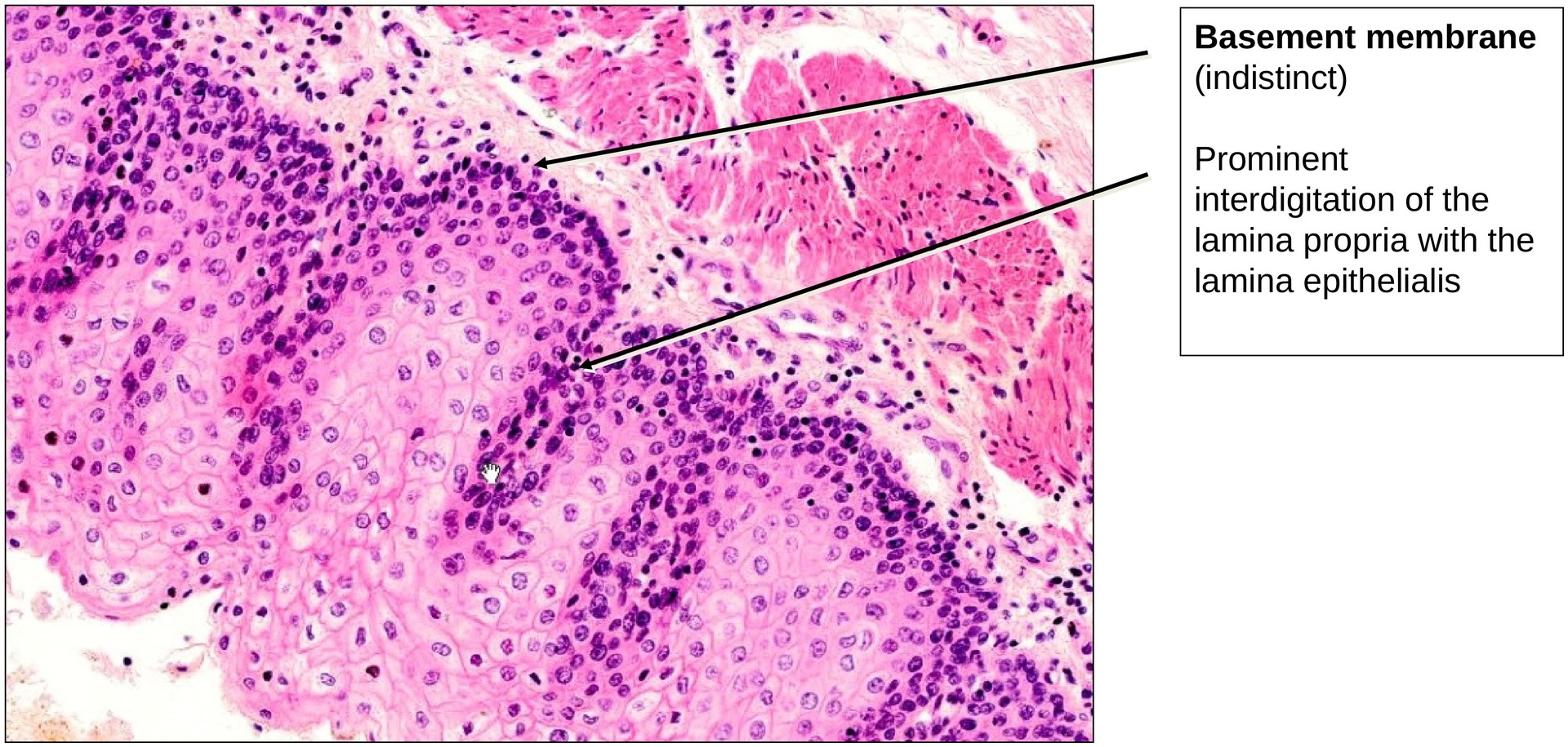 Stratified squamous epithelium (Oesophagus)