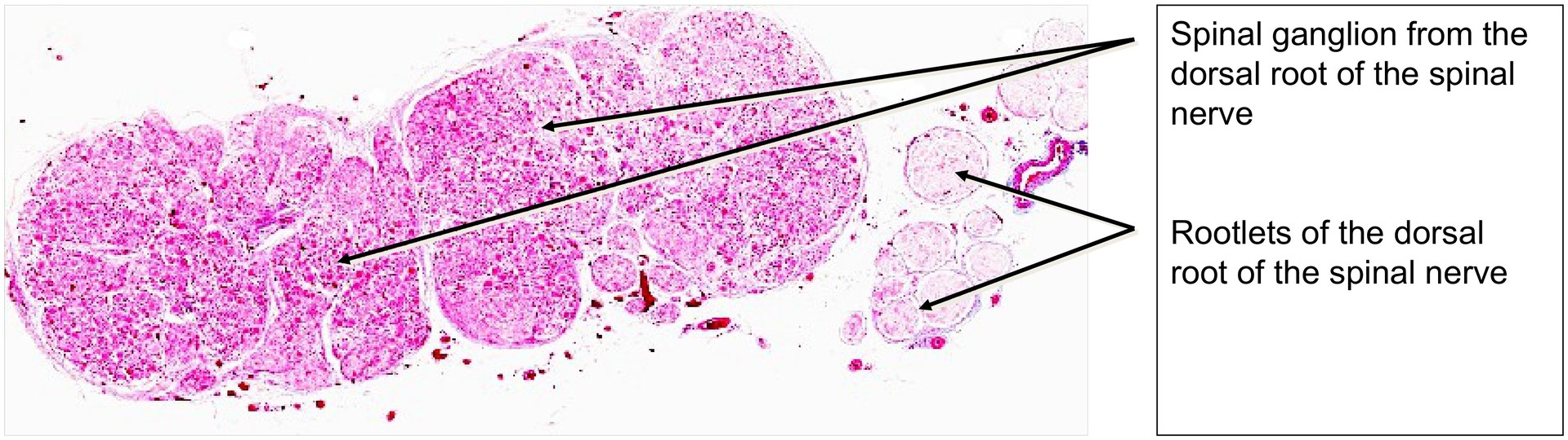 Spinal ganglion