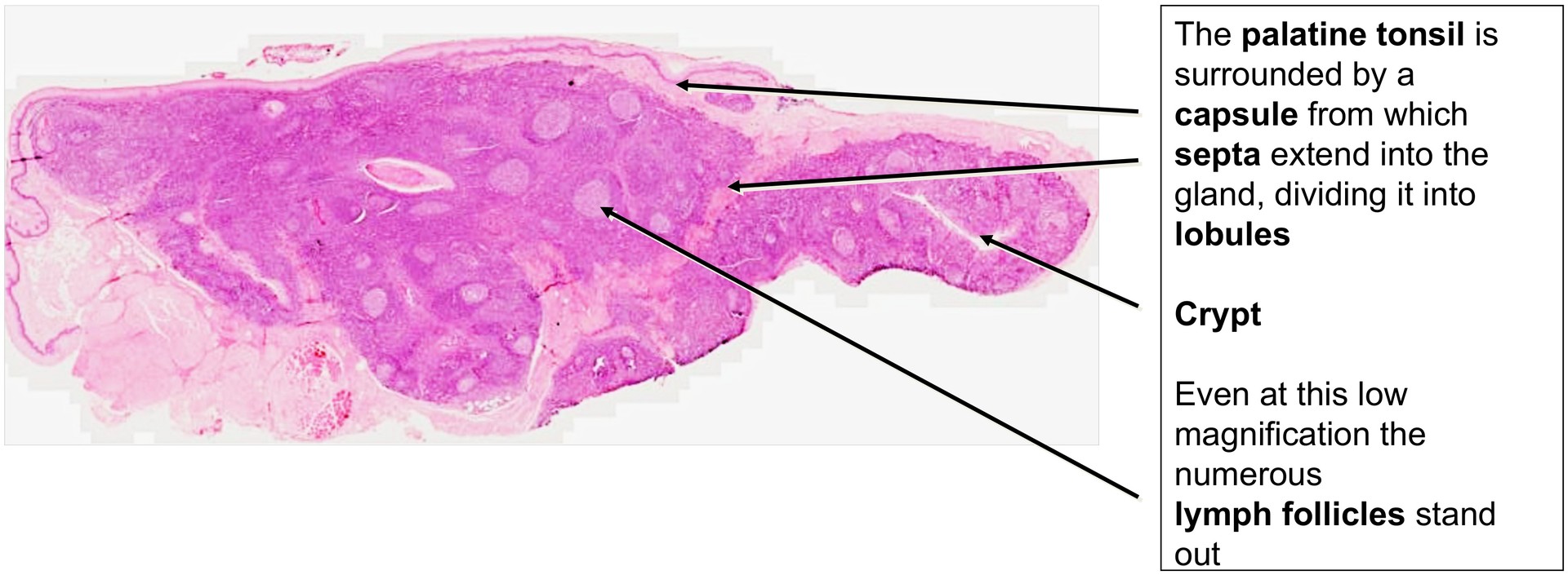 Palatine tonsil