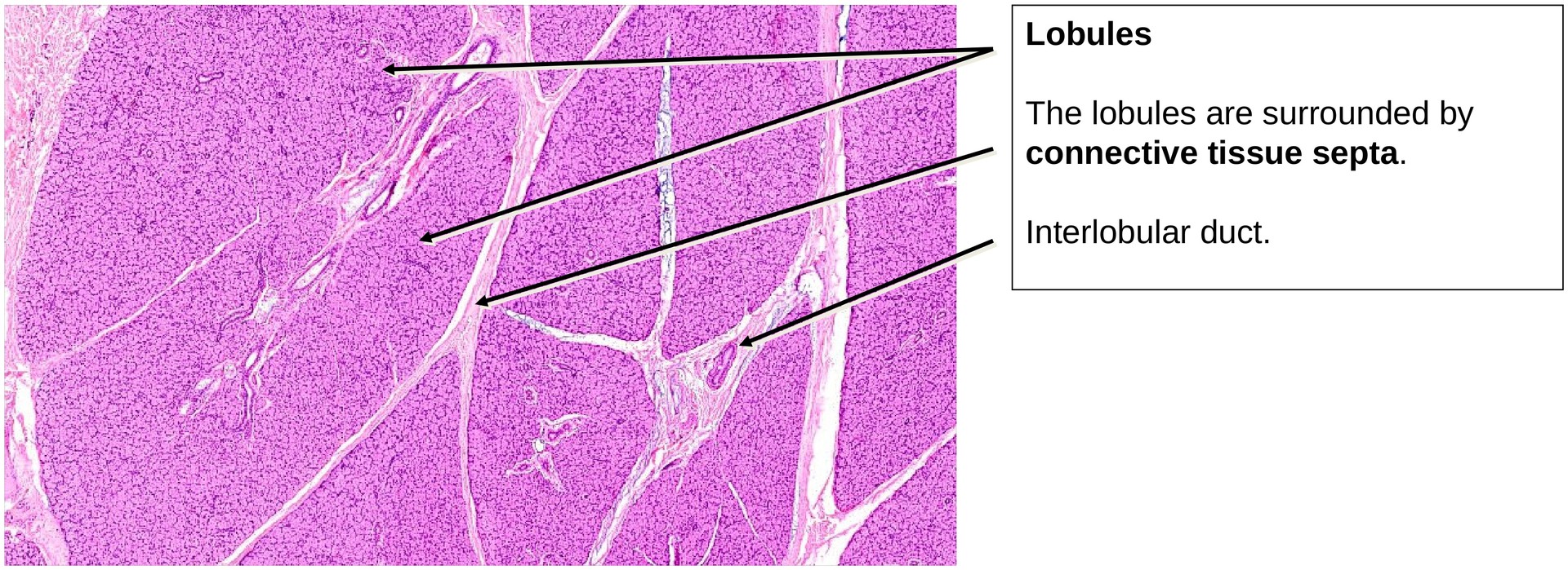 Parotid gland
