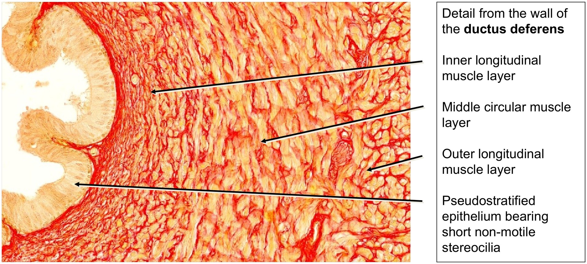 Spermatic cord