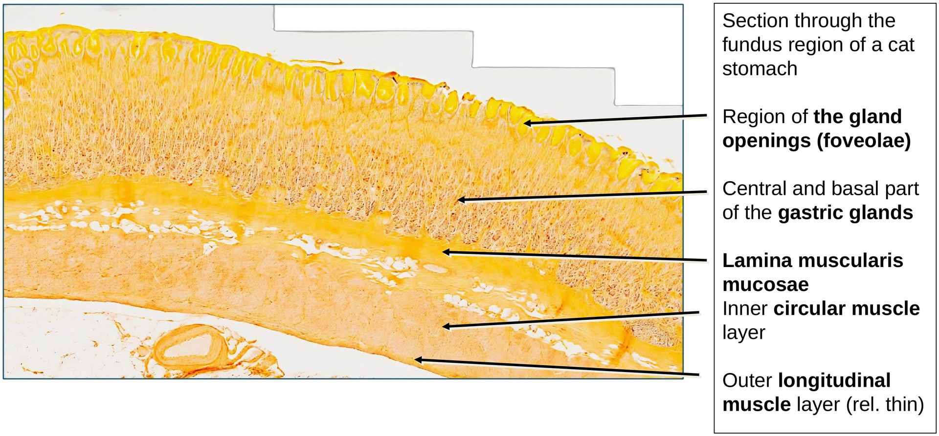 Stomach, fundus