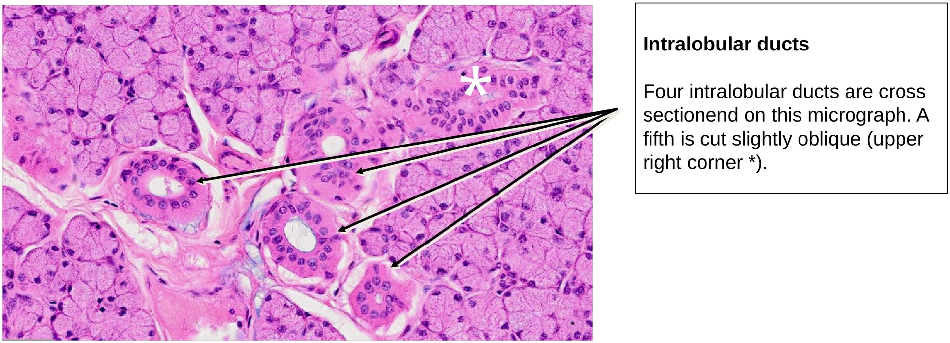 Parotid gland