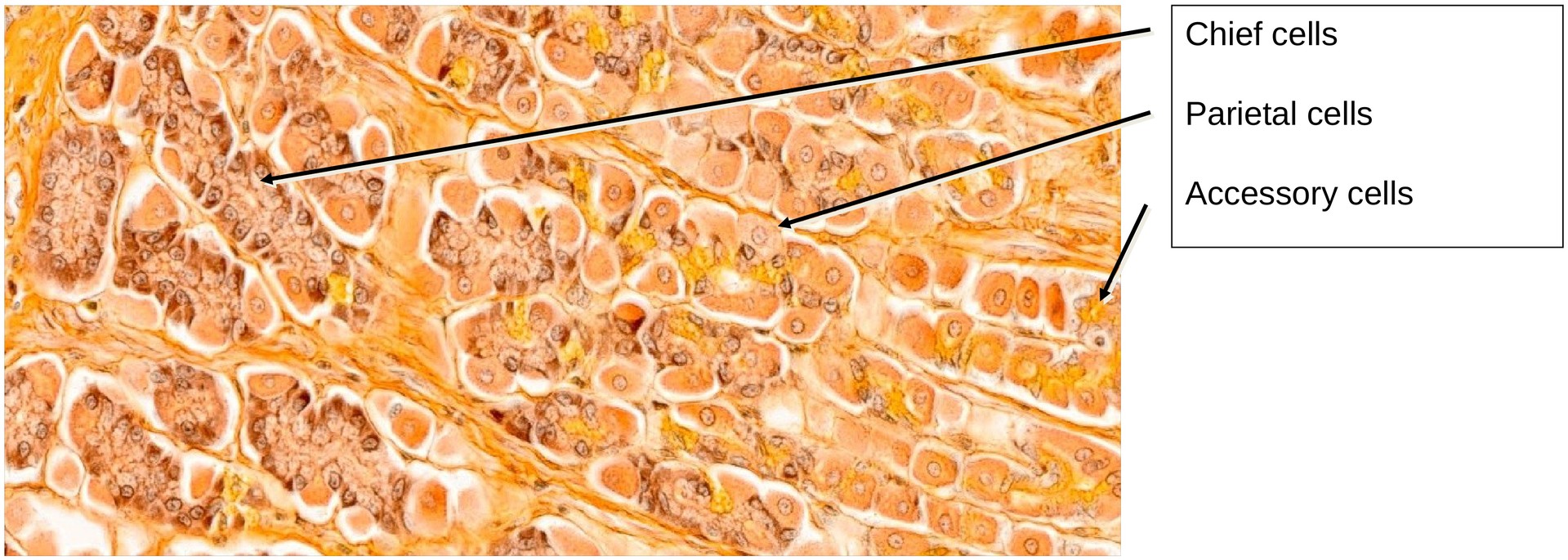Stomach, fundus