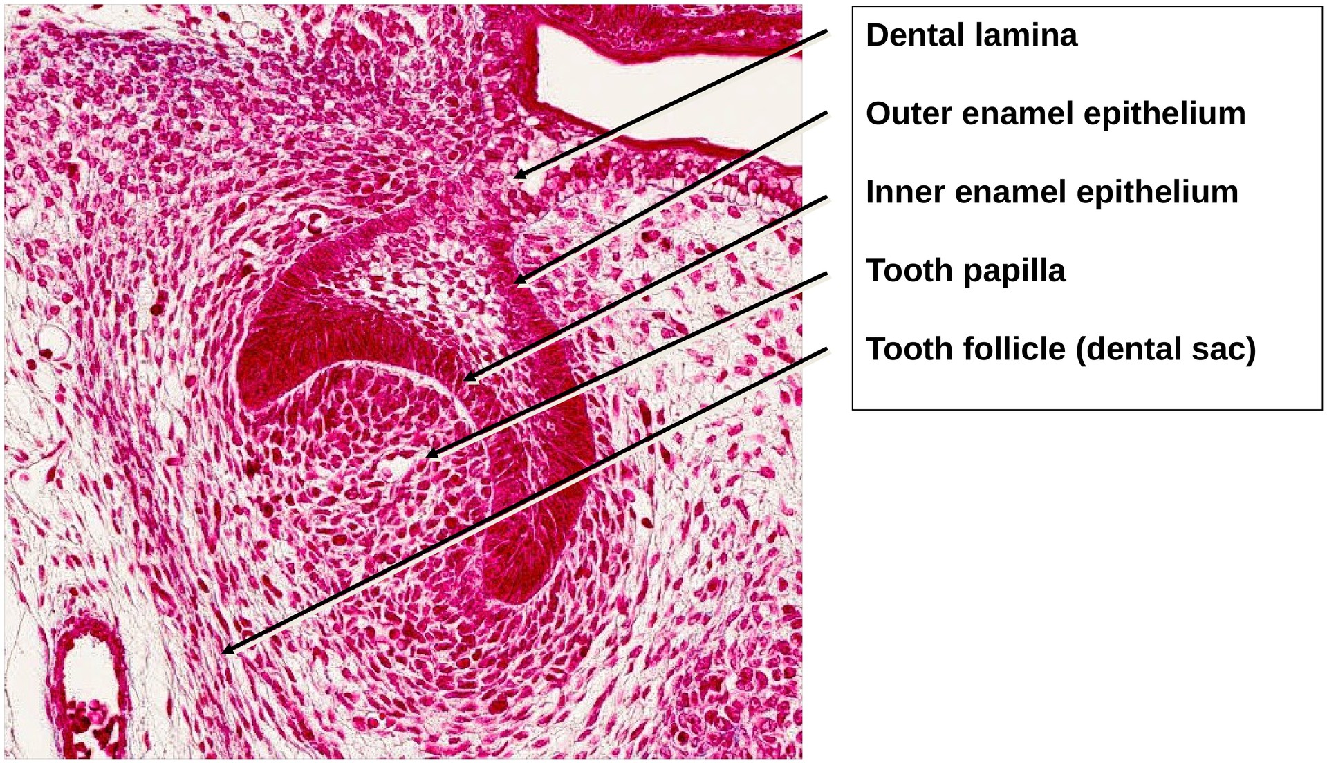 Tooth development I