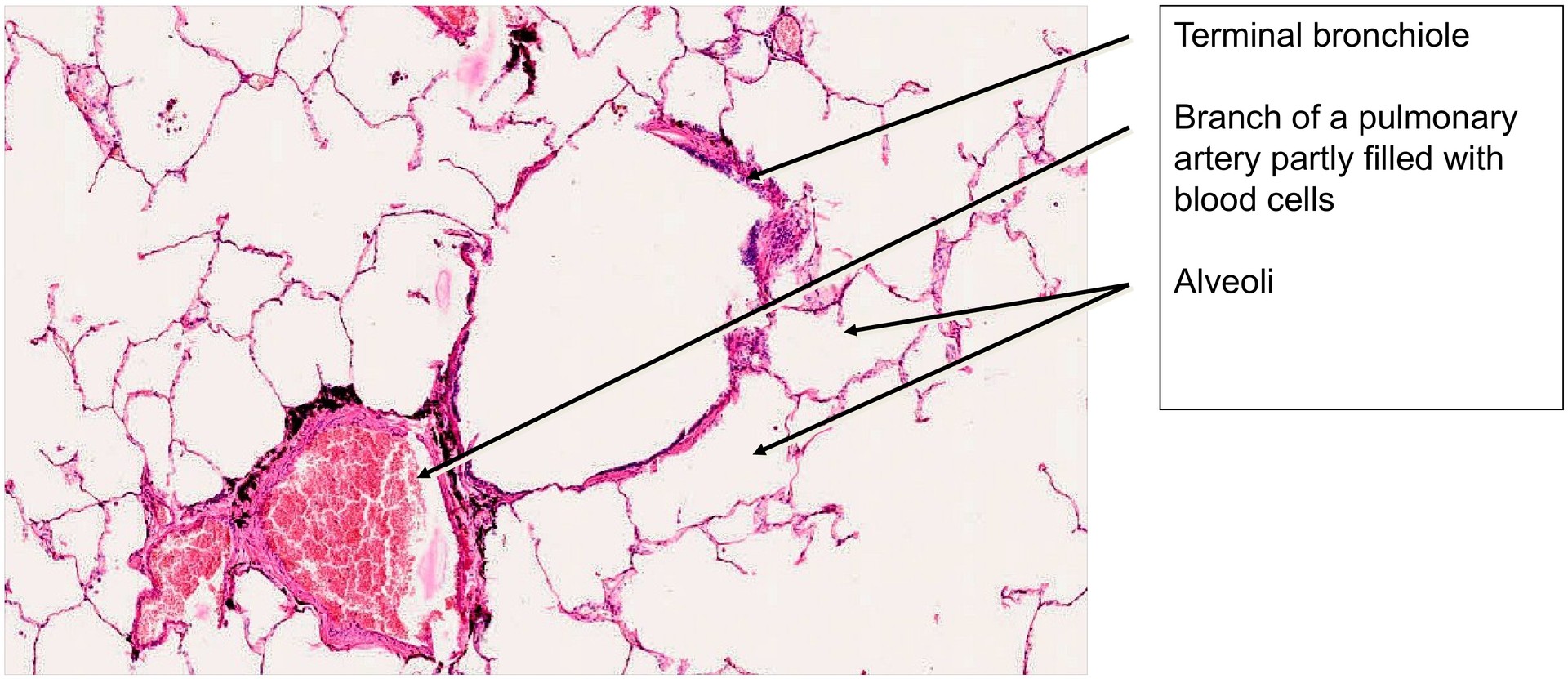 Lung adult