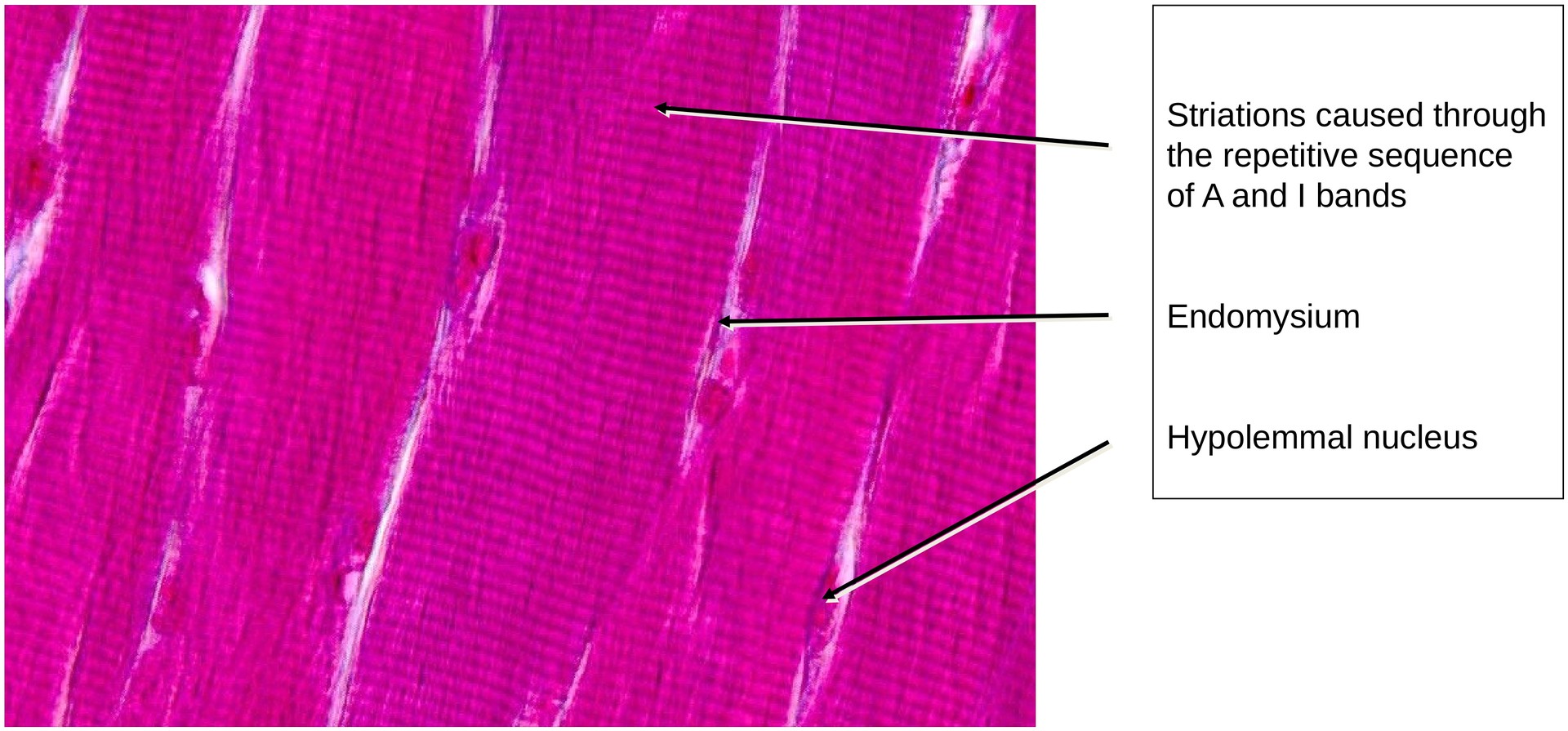 Skeletal muscle (longitudinal)