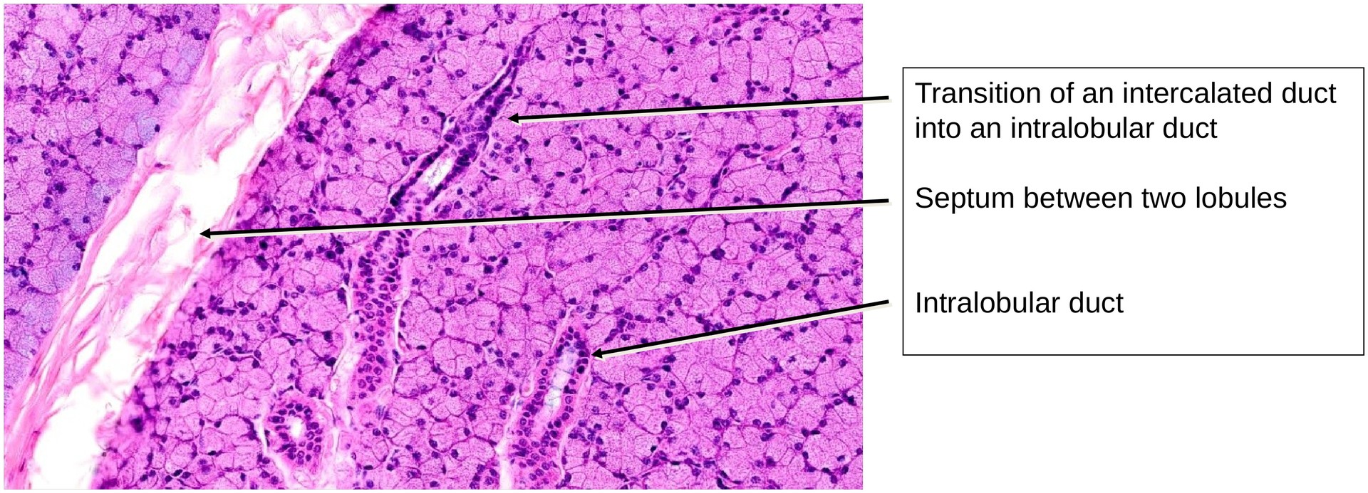 Parotid gland