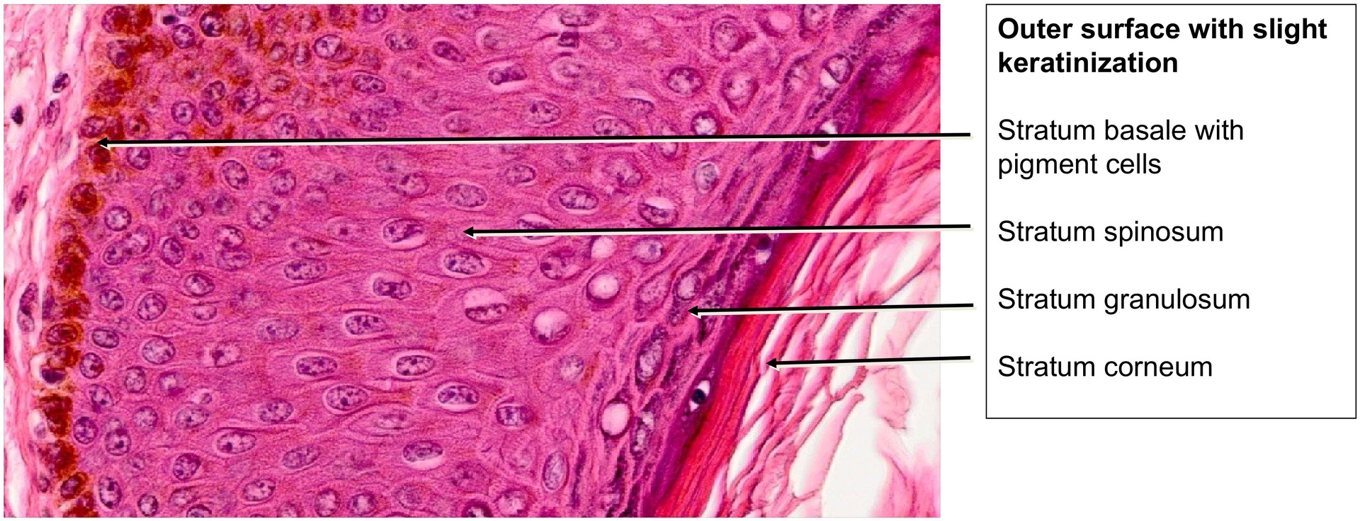 Labium minus
