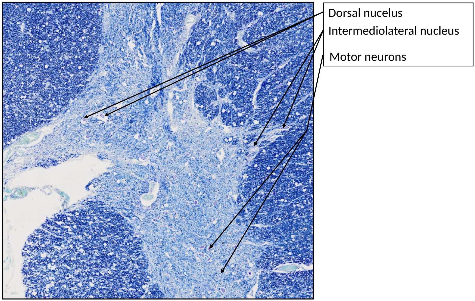Spinal cord, thoratic