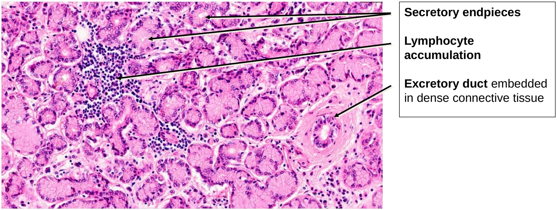 Lacrimal gland