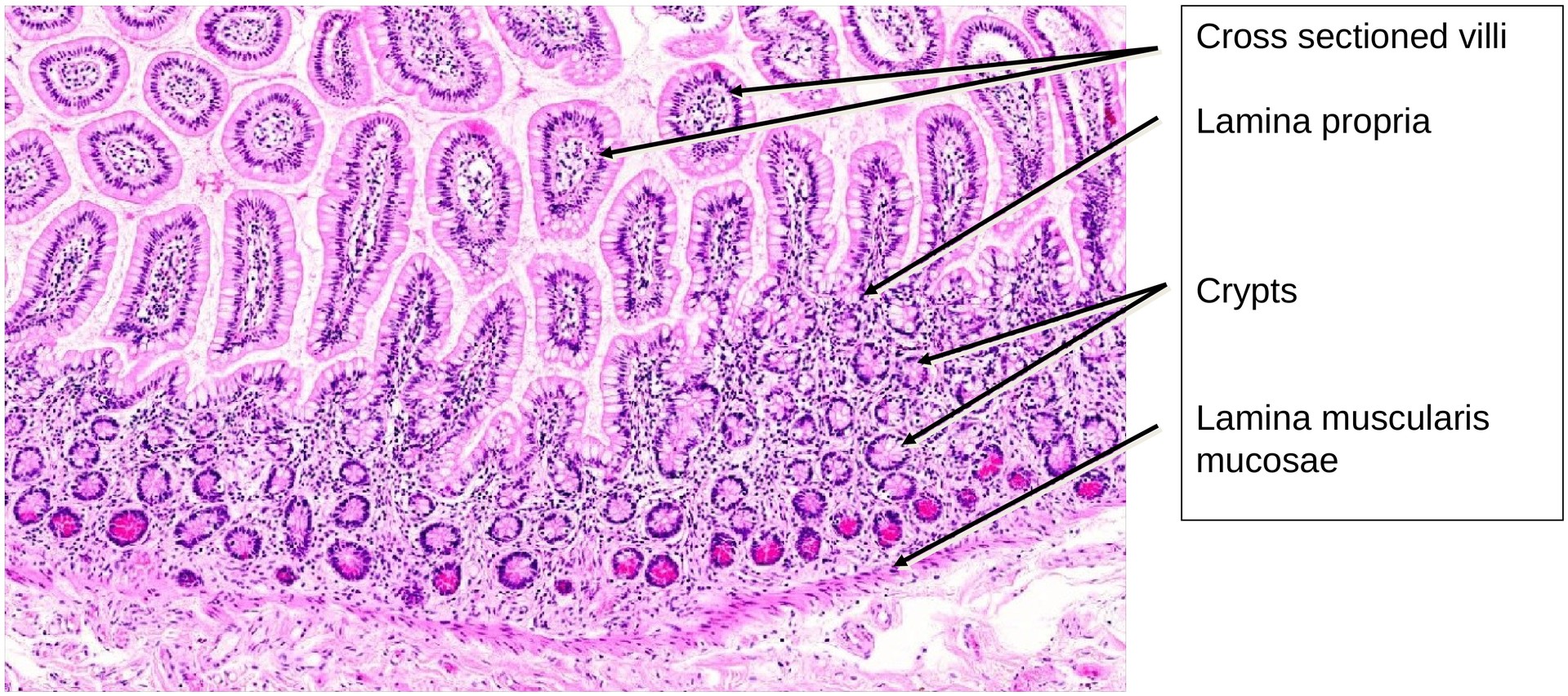 Ileum, Human 2
