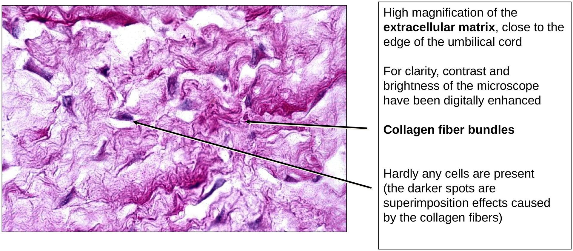 Fetal connective tissue (Umbilical Cord)