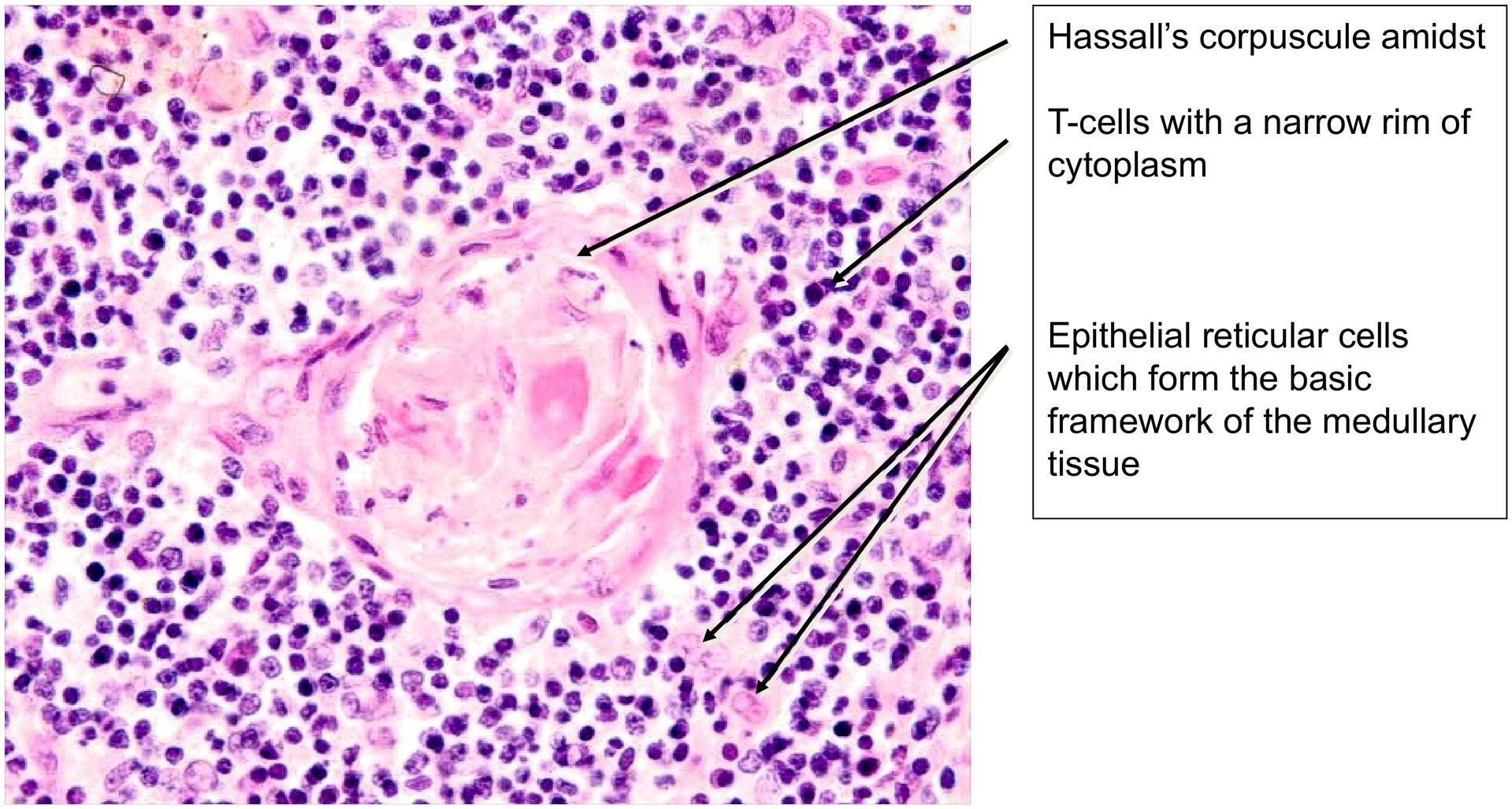 Thymus, child