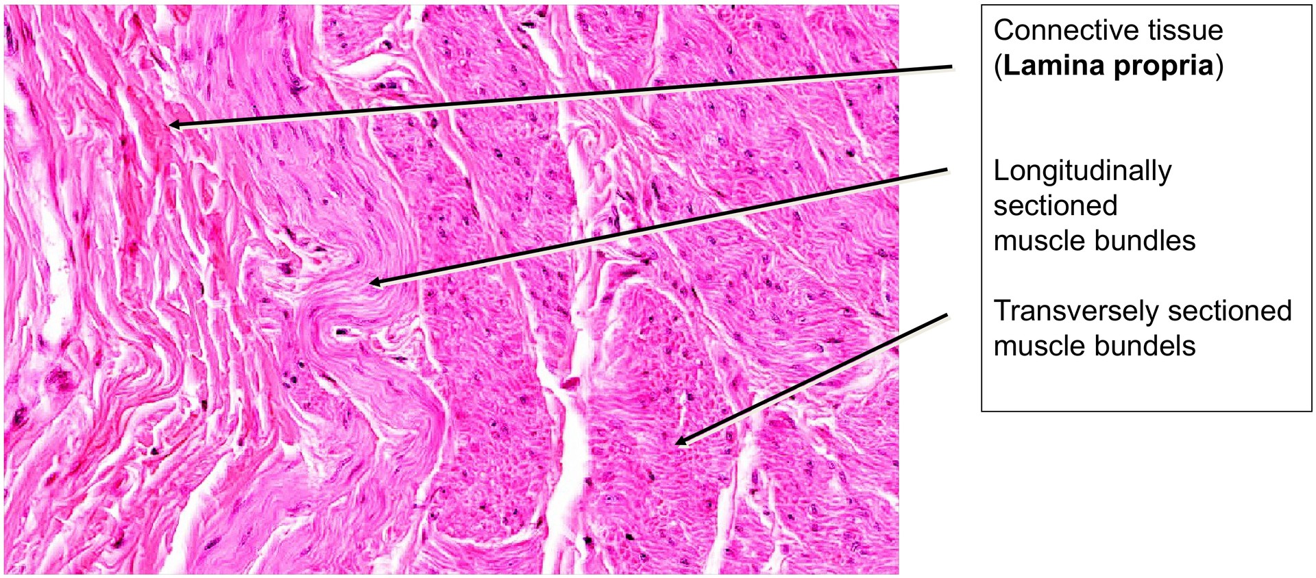 Urinary bladder