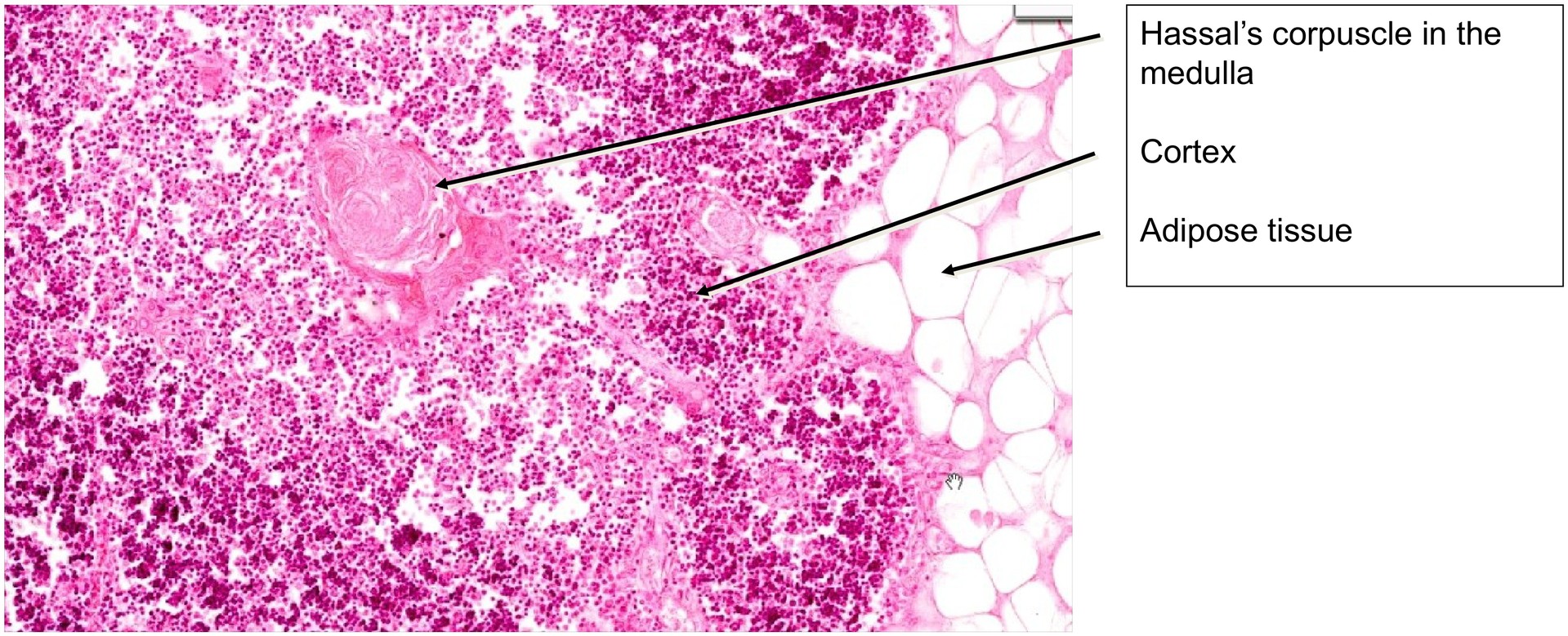 Thymus, adult