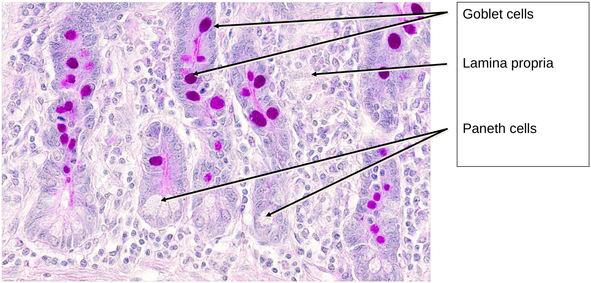 Jejunum, human 1