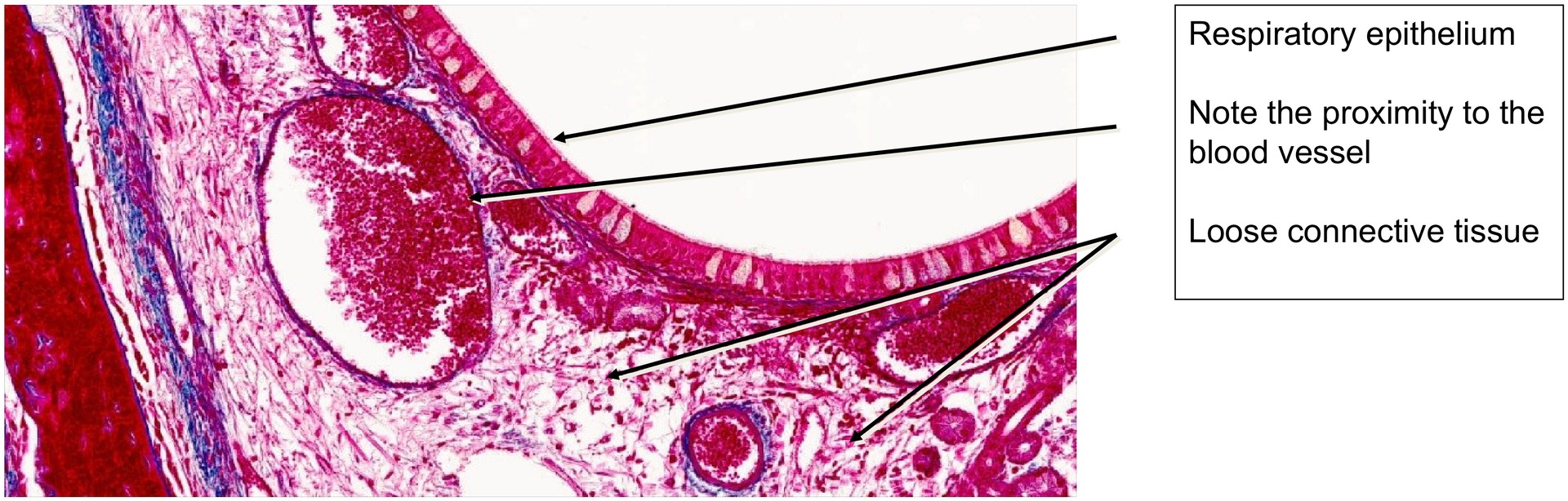 Nasal concha
