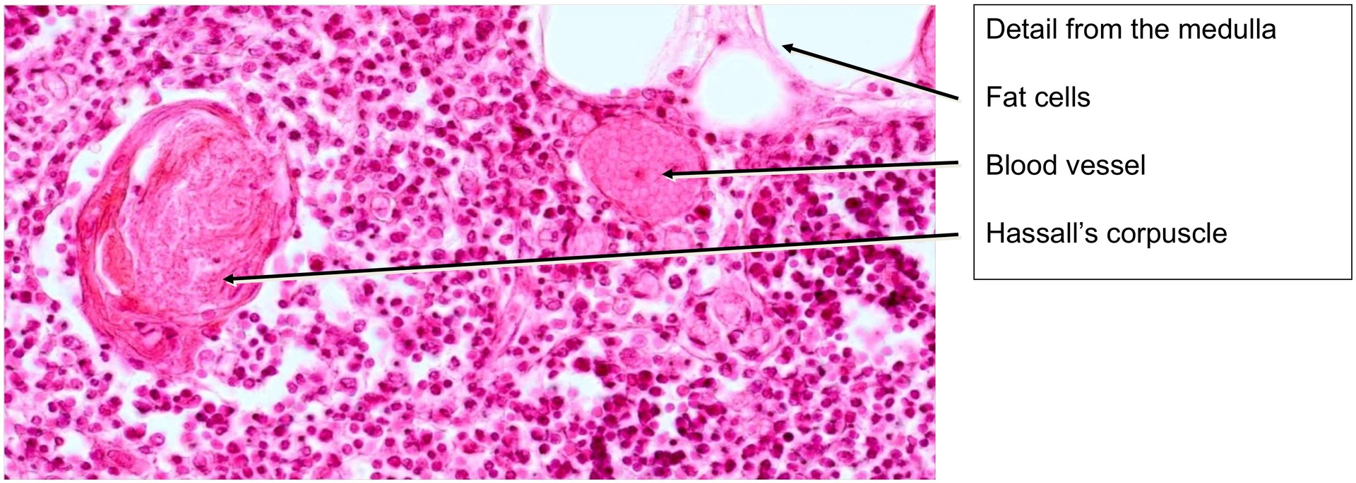 Thymus, child