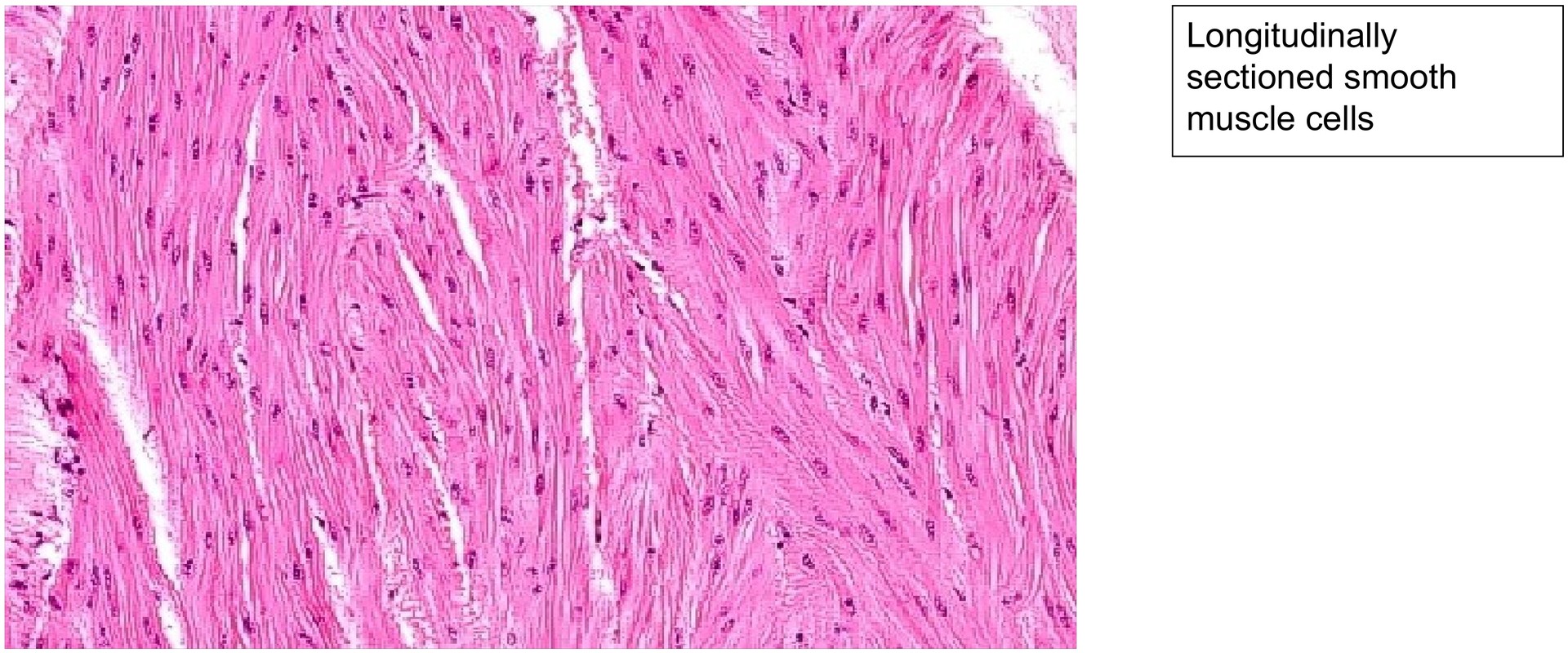 Urinary bladder