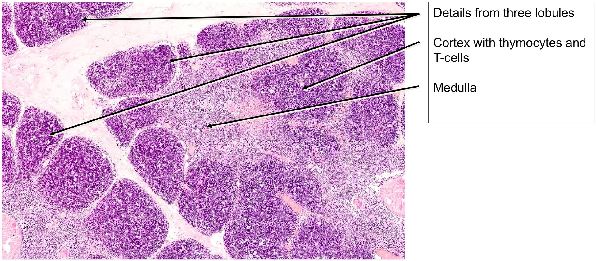 Thymus, child