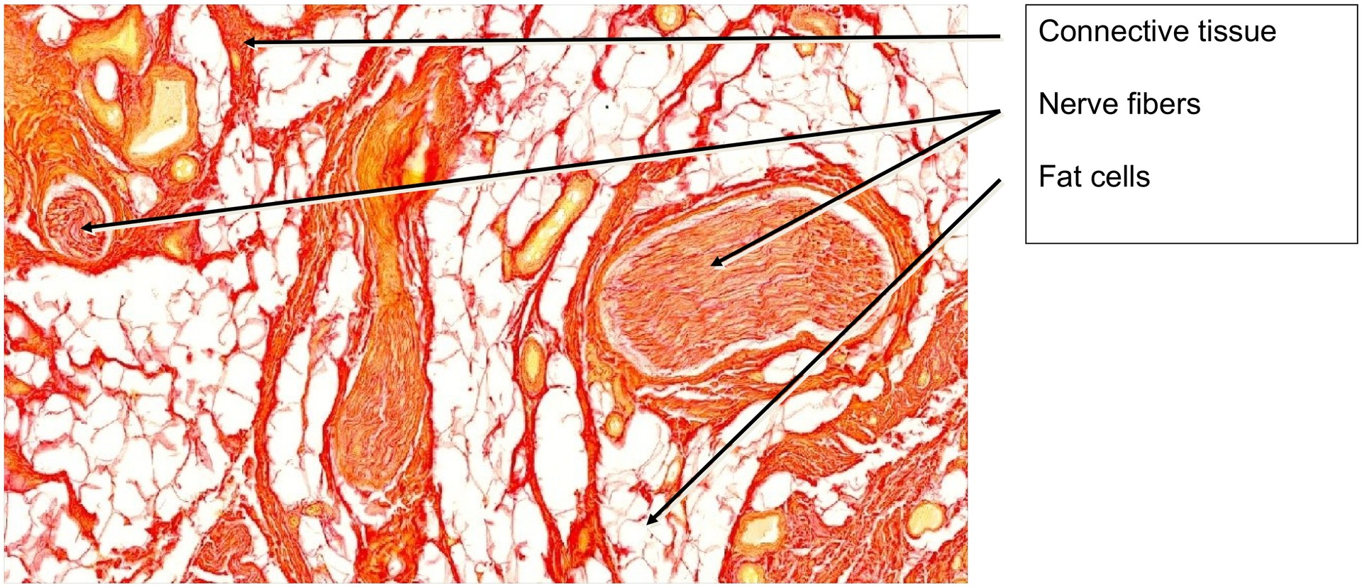 Spermatic cord