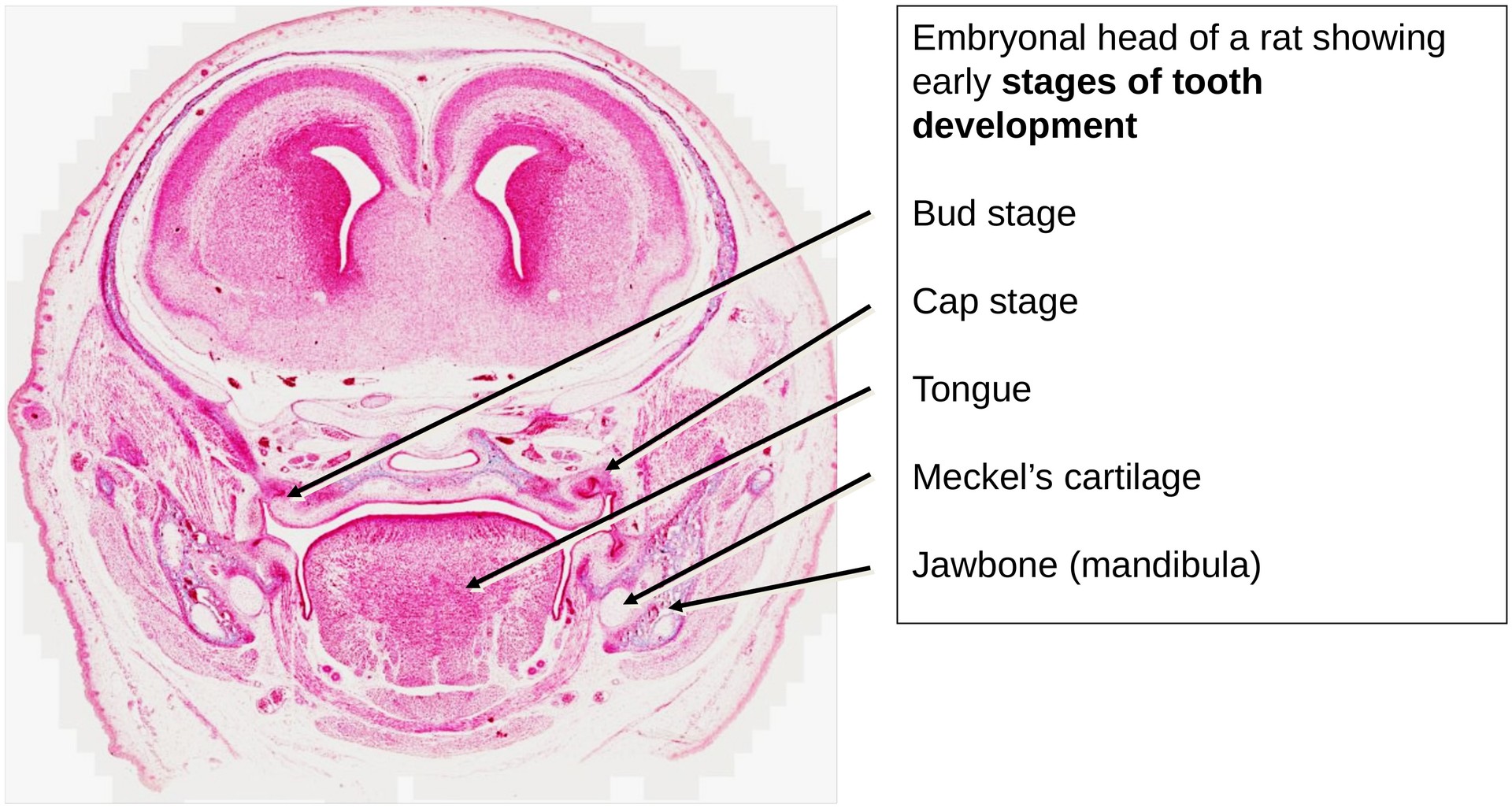 Tooth development I