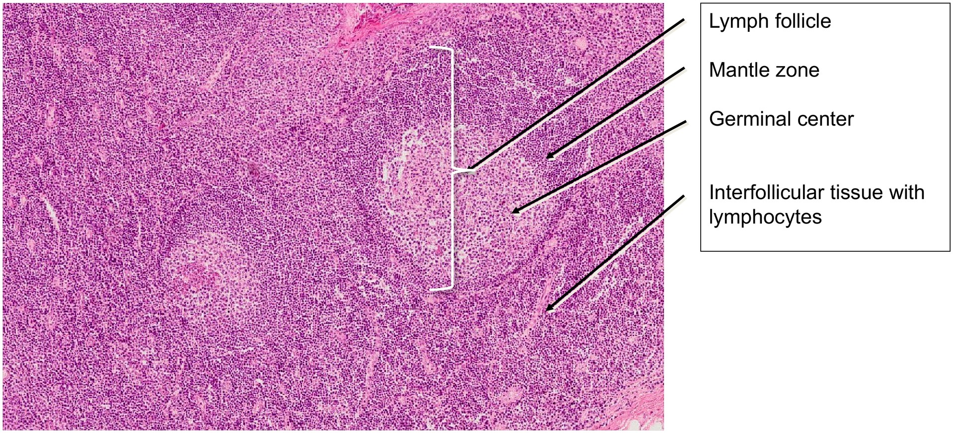 Palatine tonsil