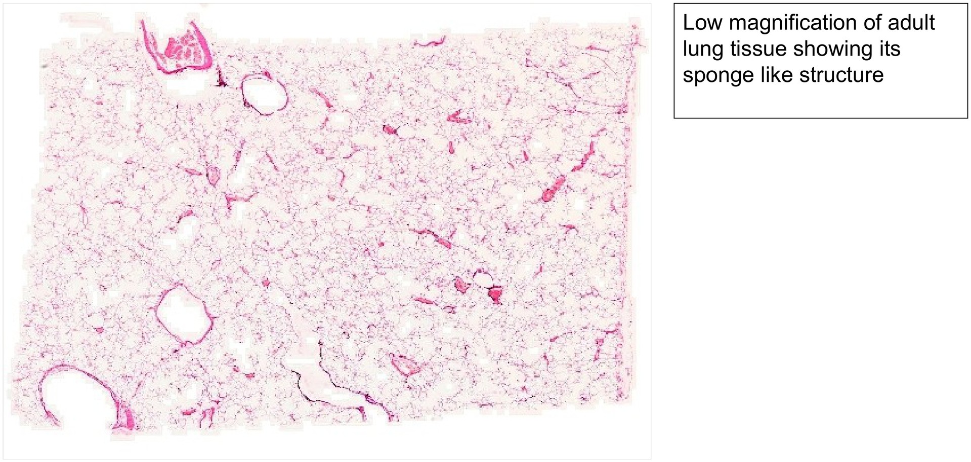 Lung adult