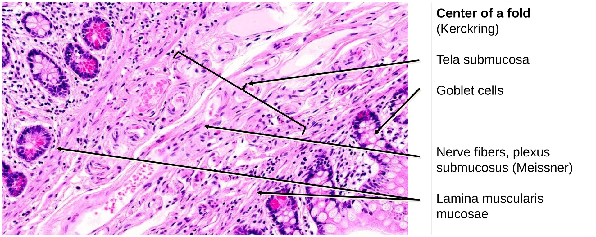 Ileum, Human 2