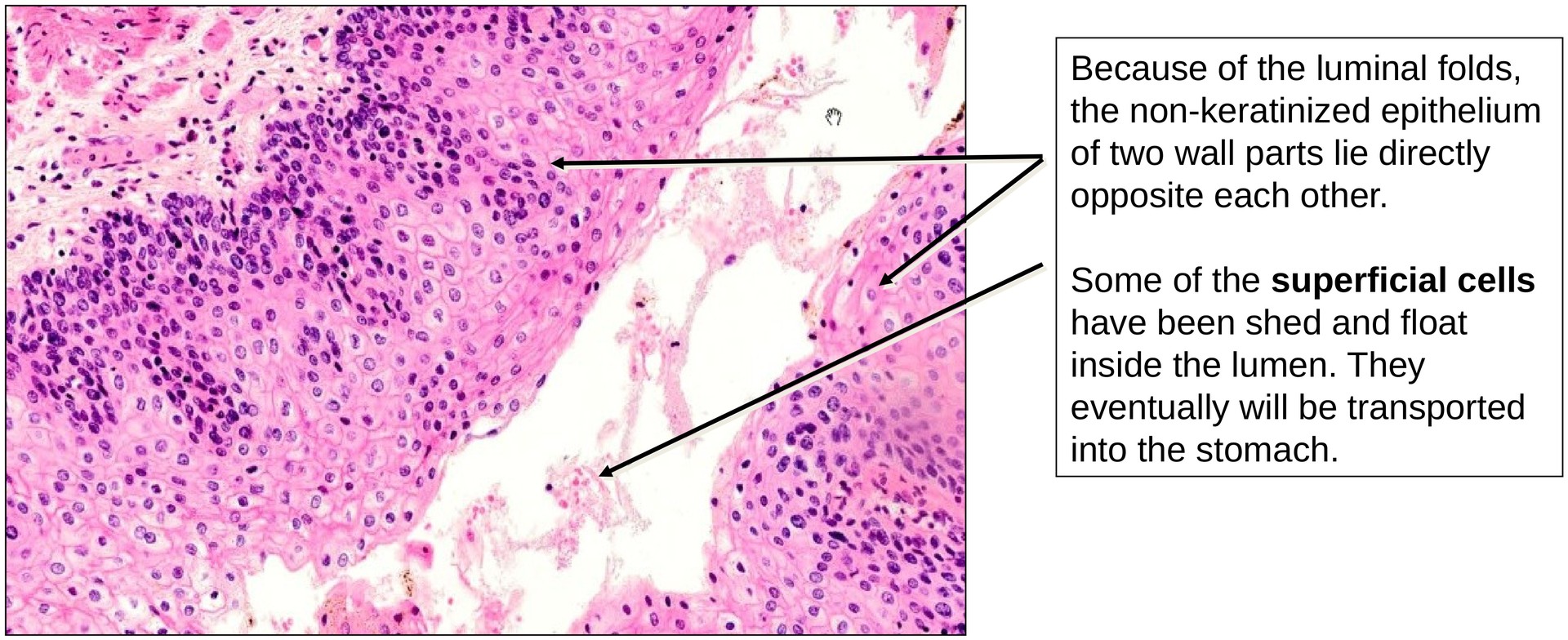 Stratified squamous epithelium (Oesophagus)