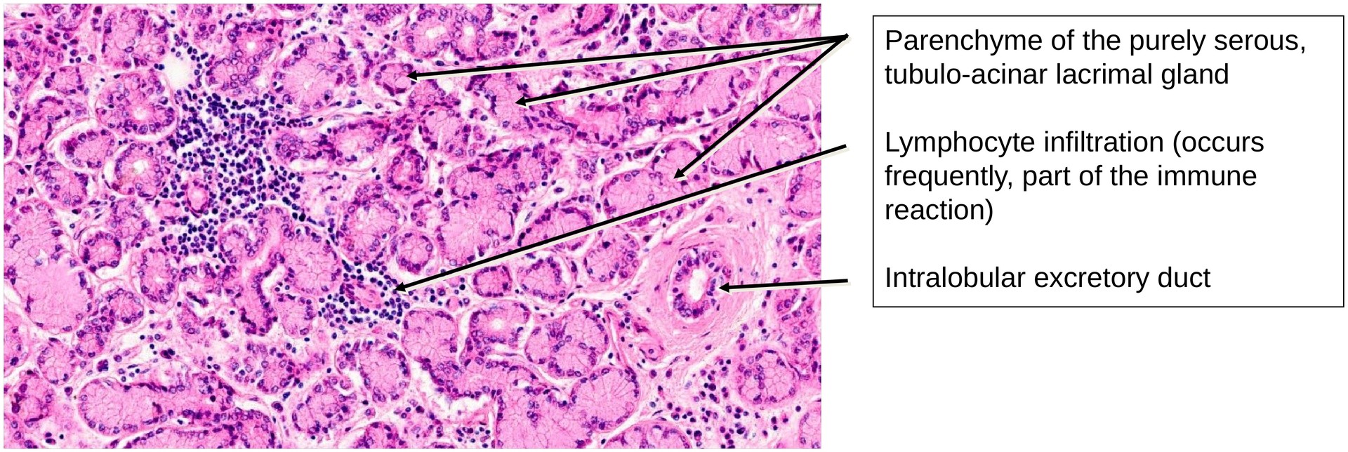 Lacrimal gland