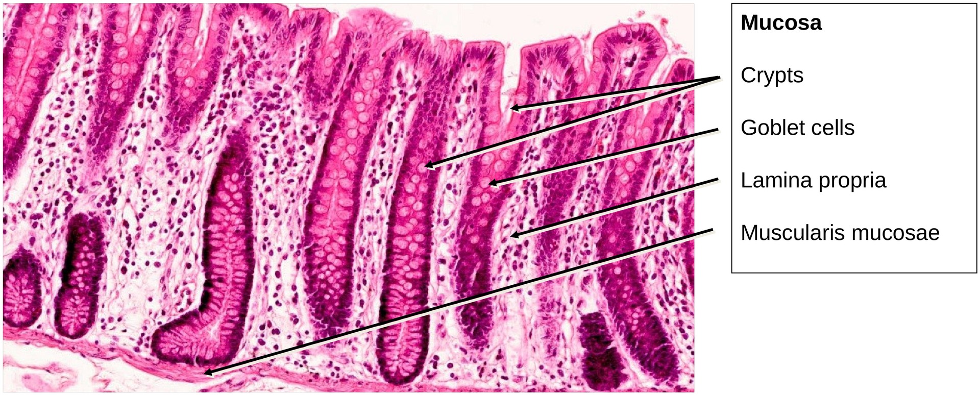 Colon