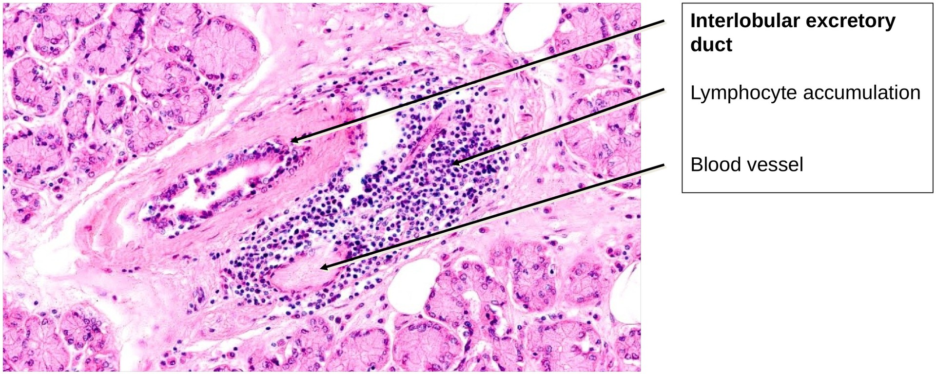 Lacrimal gland