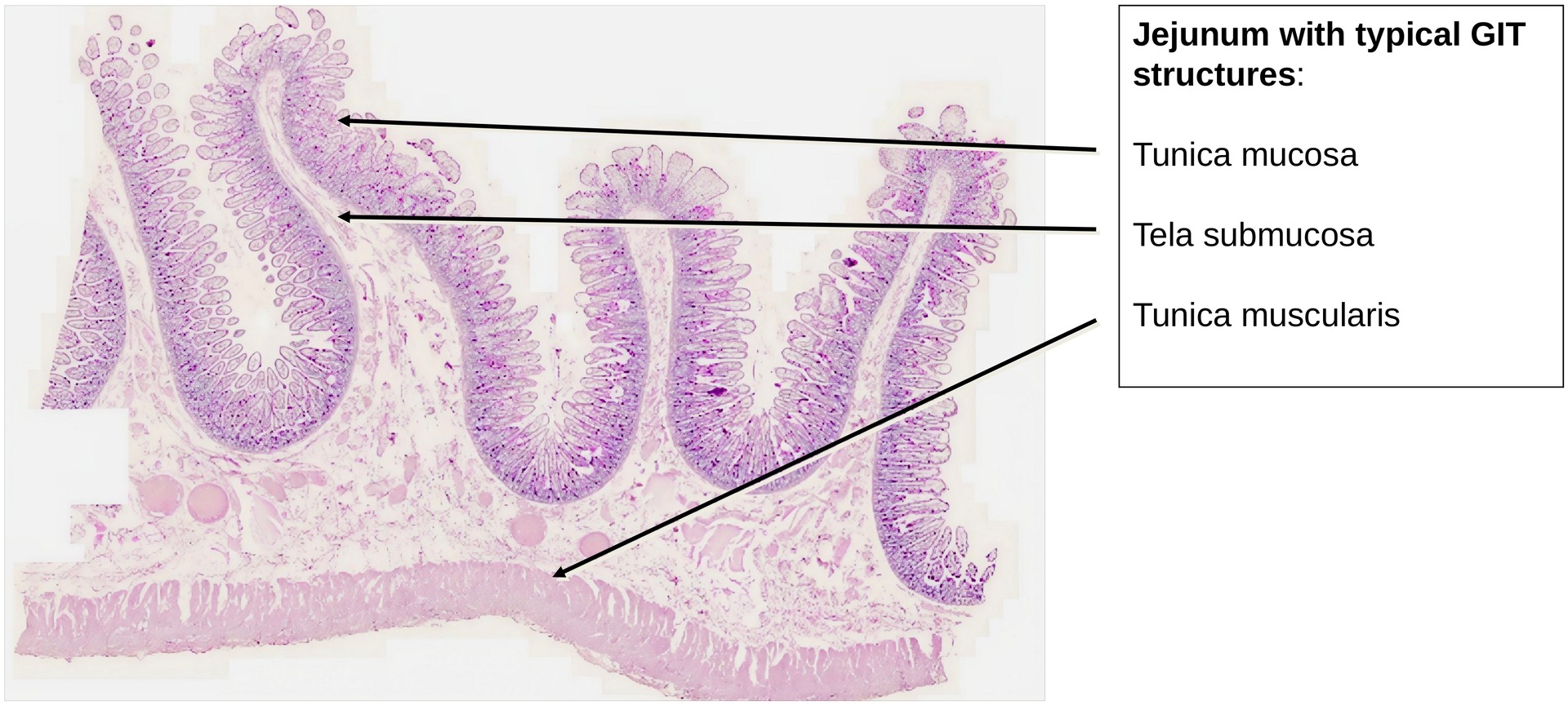 Jejunum, human 1