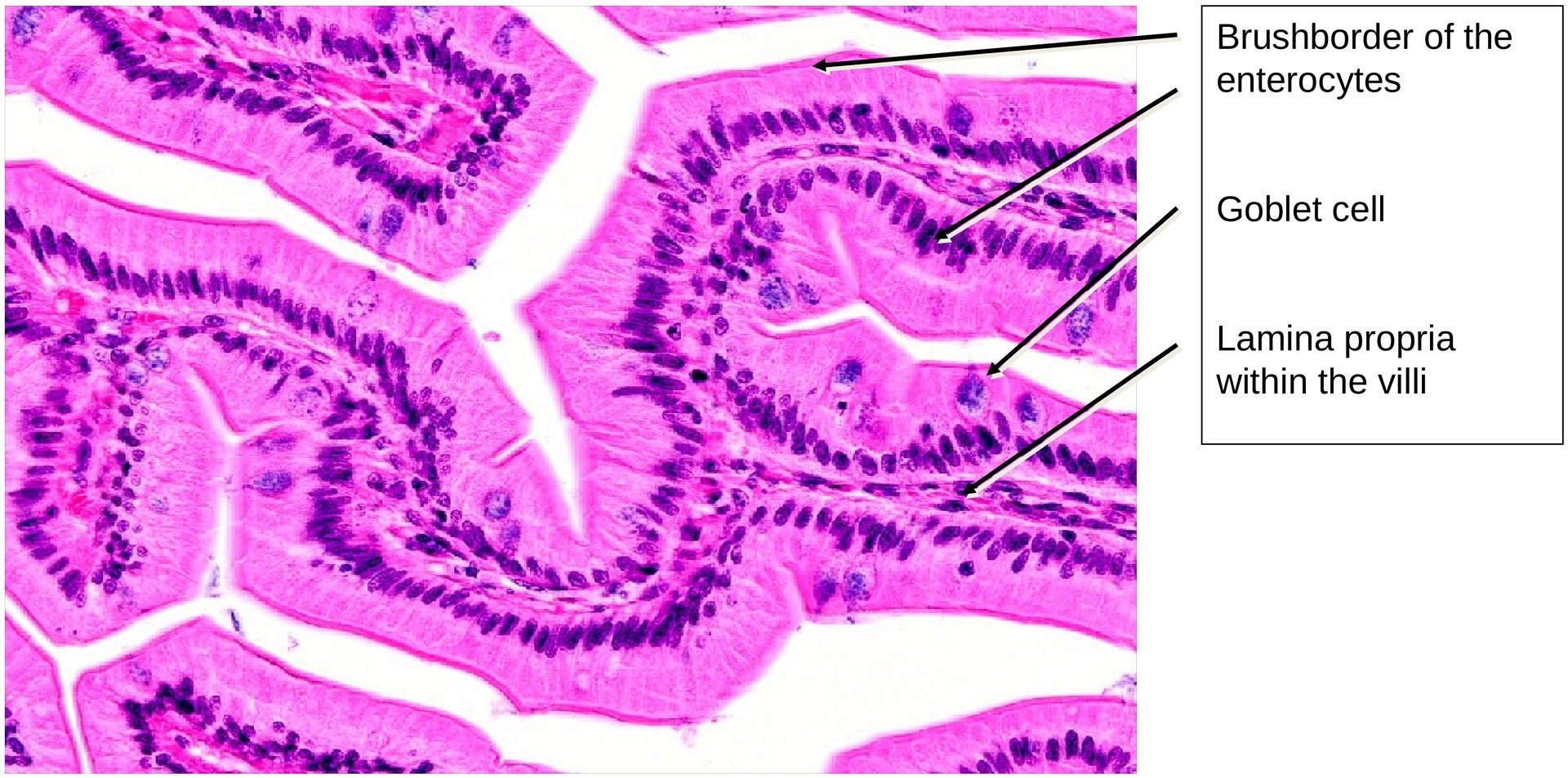 Jejunum, human 2